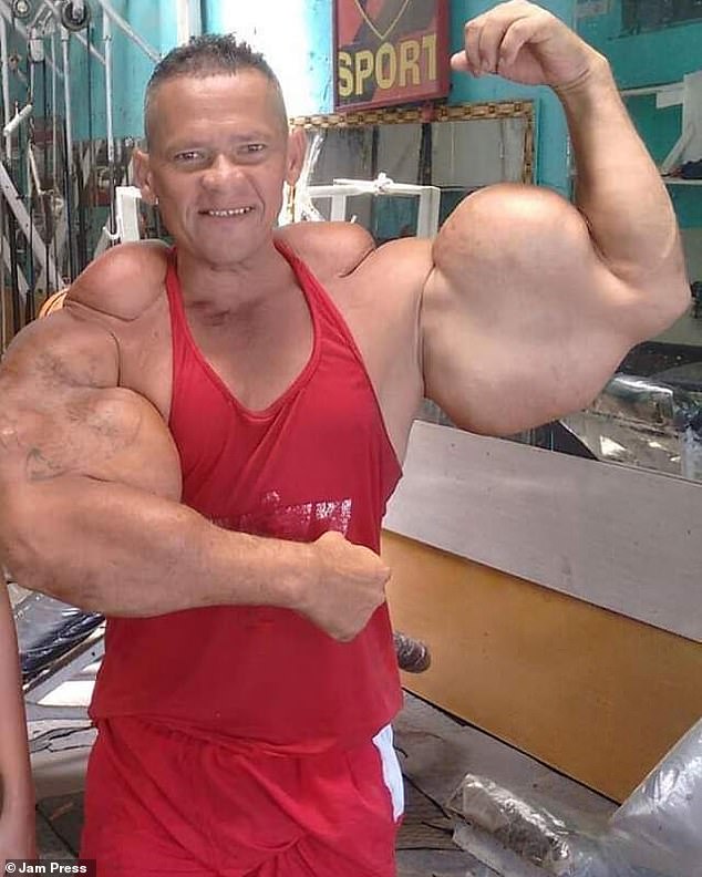Bodybuilder famed for injecting alcohol and oil into his arms dies at 55