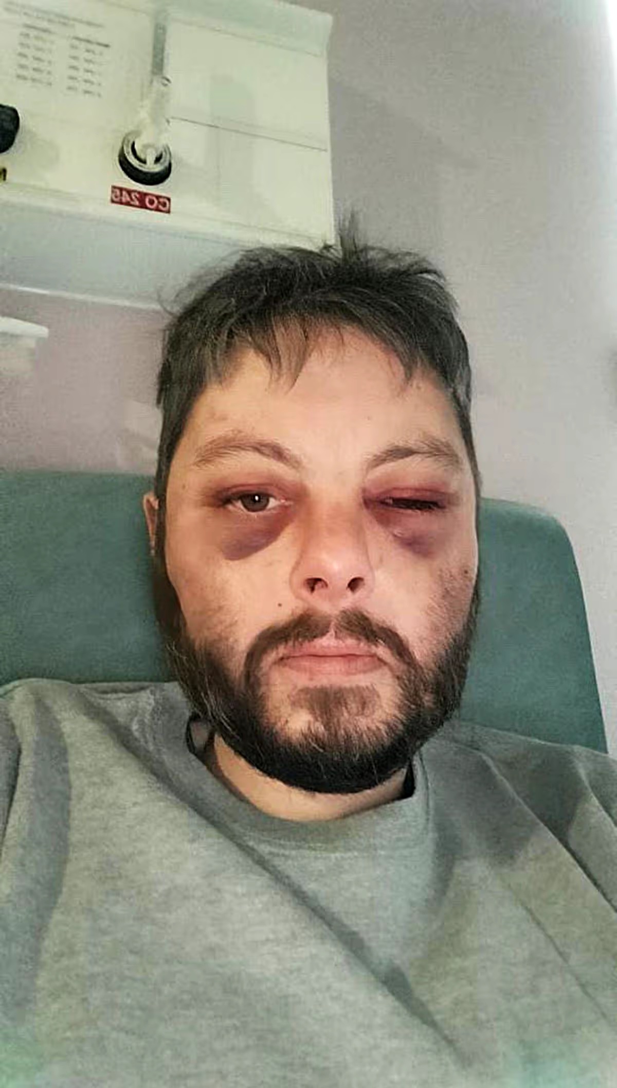 James Self's injuries sustained from physical violence