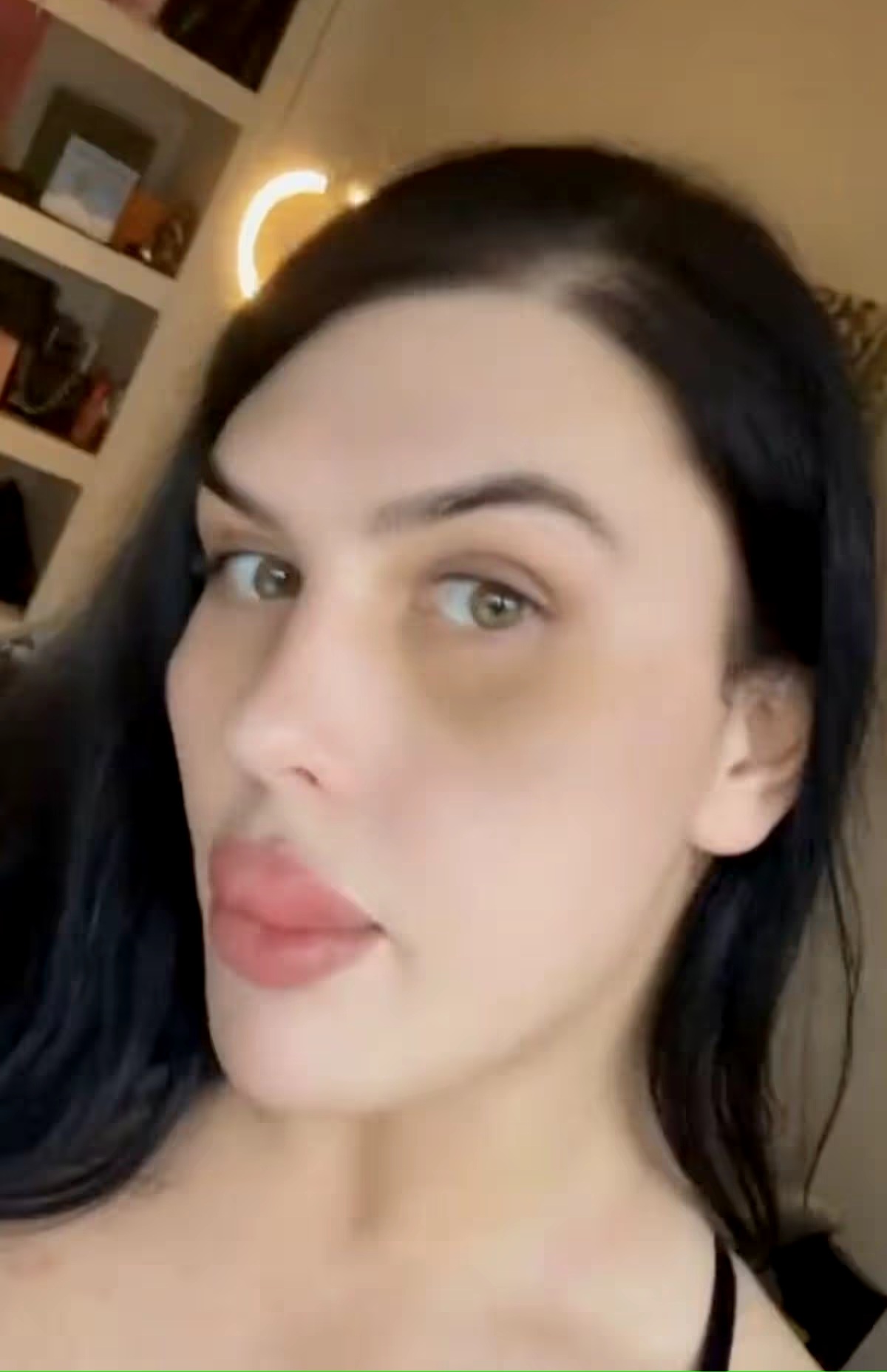 Now showing Sofia without fillers in her cheeks and jaw