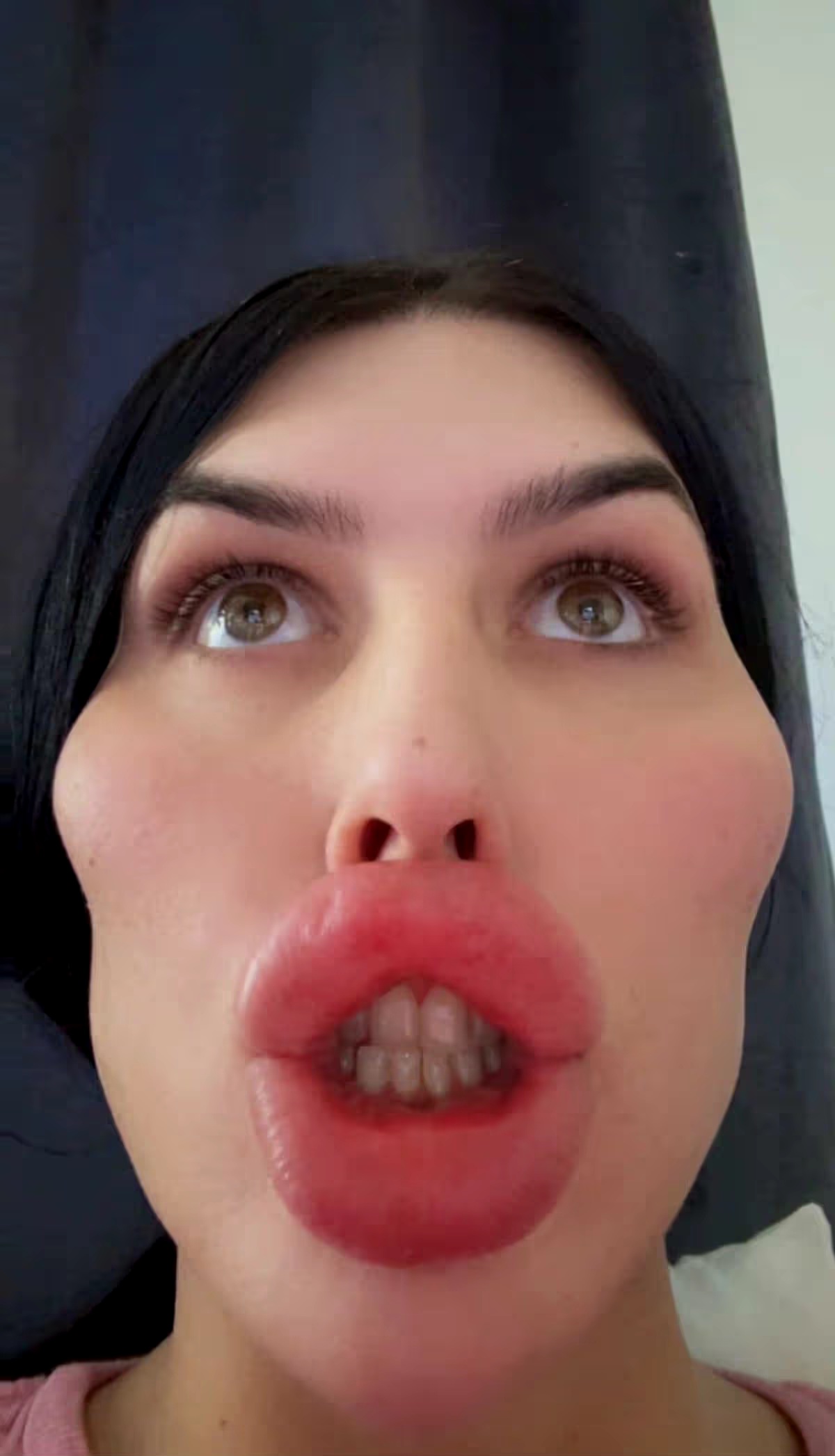 Sofia Lips showing her enhanced lips