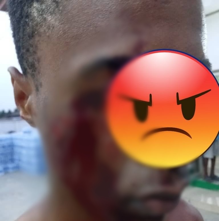 Woman arrested for allegedly stabbing a 16-year-old boy in Lagos