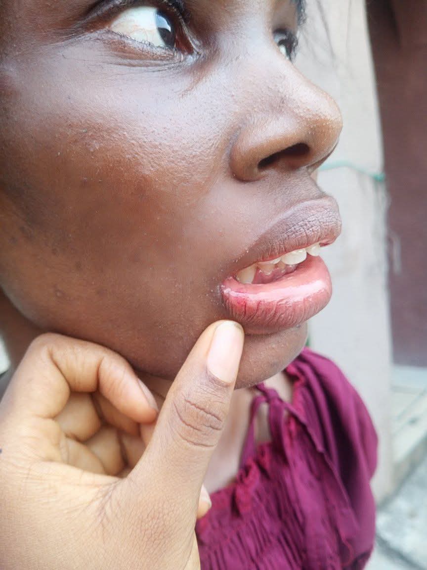 Odinakachukwu Uwadiegeu shares her experience of domestic violence.