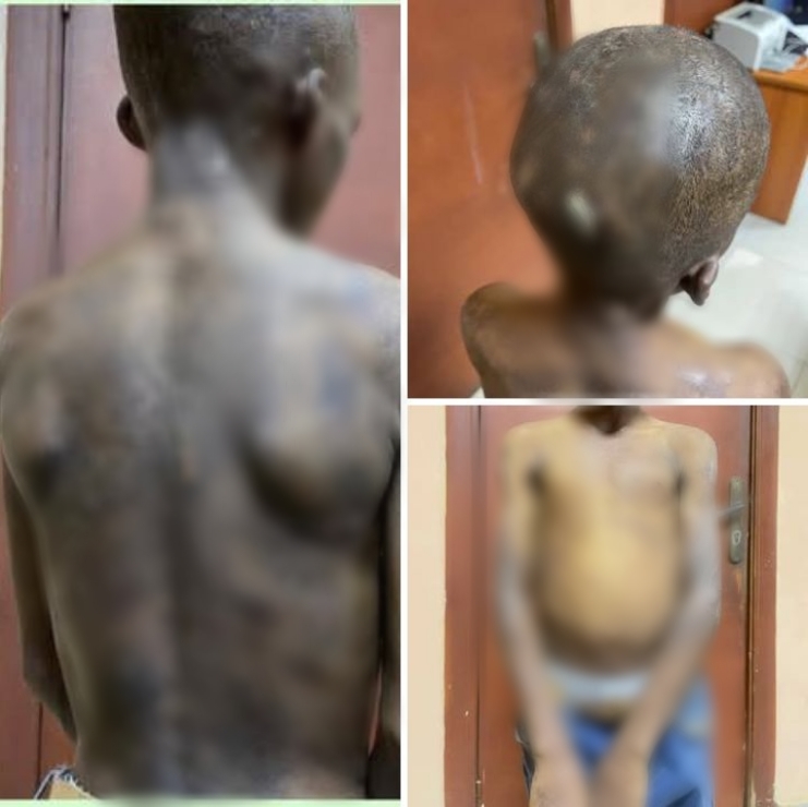 Image of the boy rescued by Lagos State Government