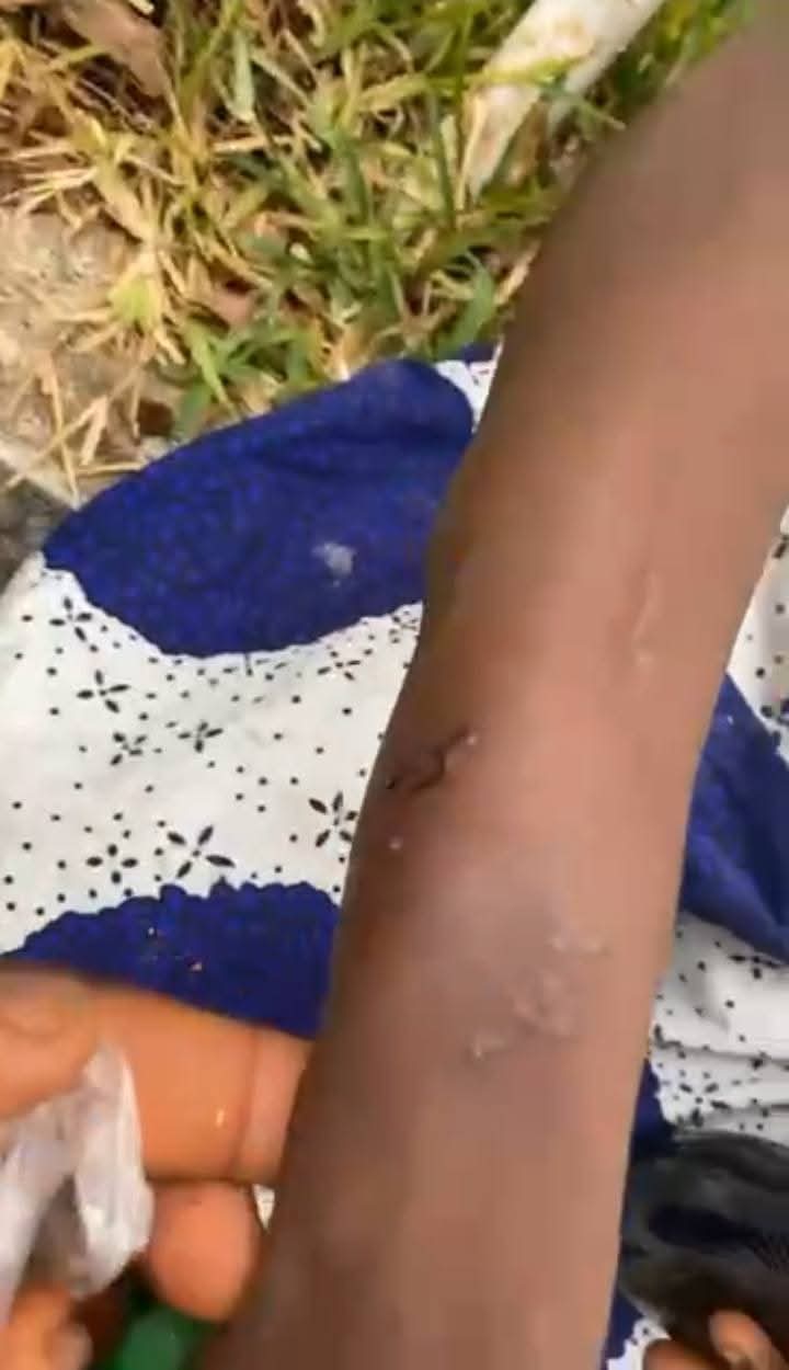 Man accused of torturing his maid in Benue