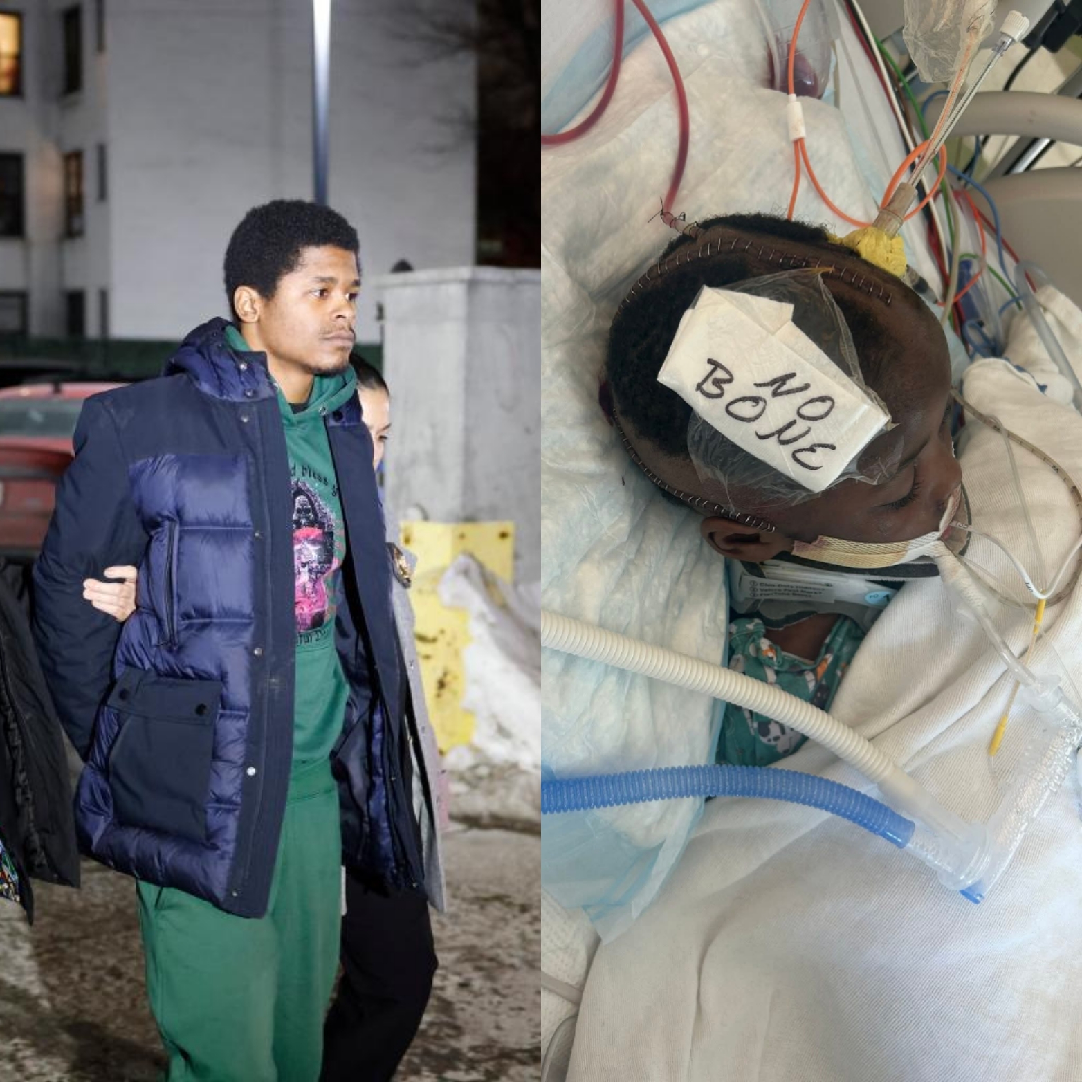 A shocked toddler lying unconscious in a hospital bed with visible injuries