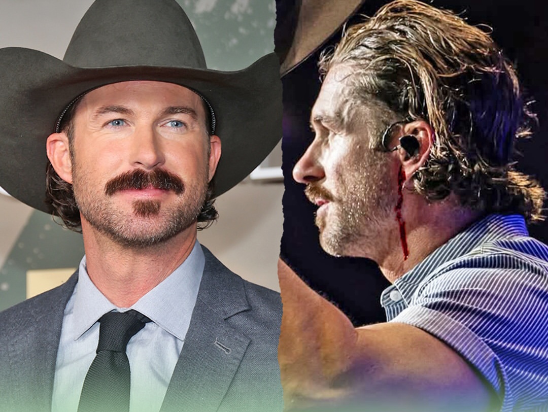 Riley Green performing on stage after being hit by a phone.