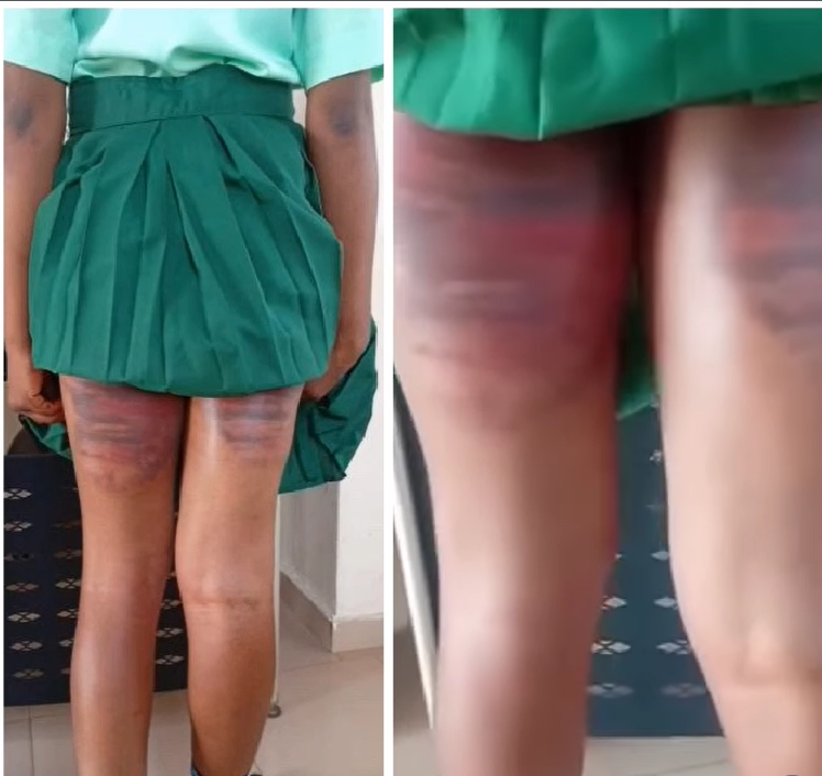 Maryiane Okonkwo, the student allegedly assaulted at Command Secondary School, Iyana Ipaja